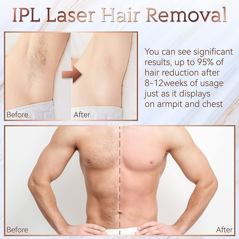 Poshewares™ IPL Hair removal Epilator